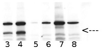 PPH1/TAP38 | Protein phosphatase 1 in the group Antibodies Plant/Algal / Photosynthesis / Light acclimation at Agrisera AB (Antibodies for research) (AS16 4084)
